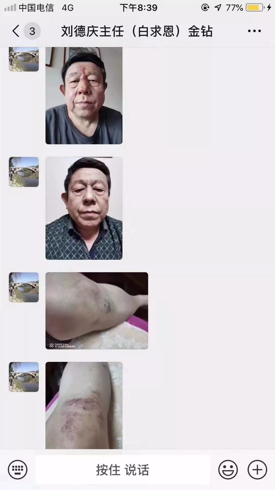 紫檀膏对皮肤有什么好处,紫檀膏治什么病