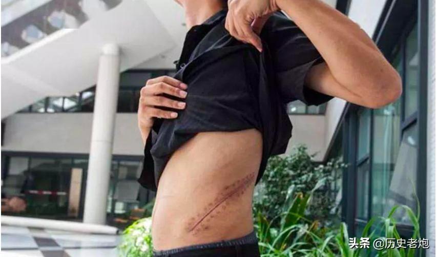 10年前卖肾少年卖苹果手机,10年前卖肾卖手机的人