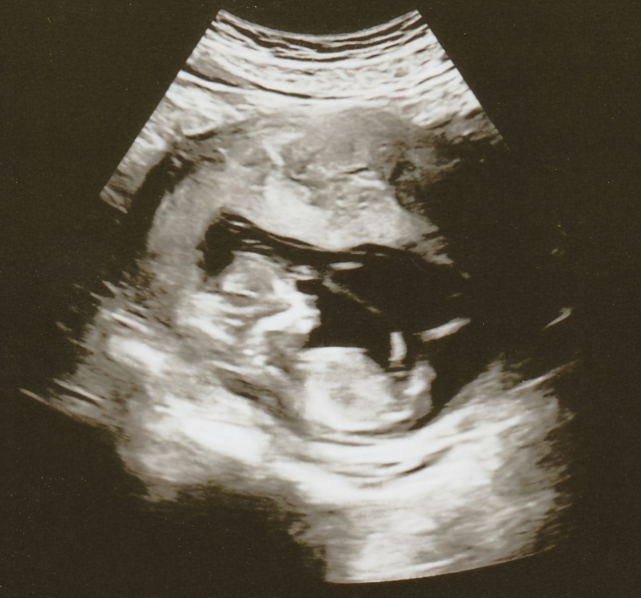 恭喜！39岁香港女星“波波姐”宣布怀孕4个月，上月才急嫁老公