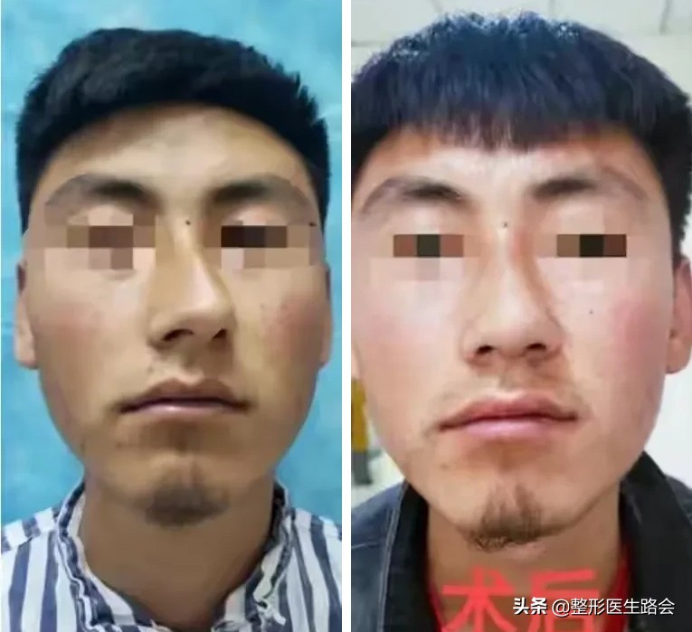 这6个坏习惯会让你越来越胖,这6种坏习惯会毁了孩子一生