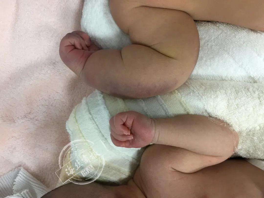 高龄产妇顺产诞下男婴,产妇顺产诞下九斤男宝