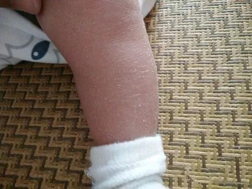 宝宝的10个“伪异常”现象，初为父母的你，遇到之后不要慌