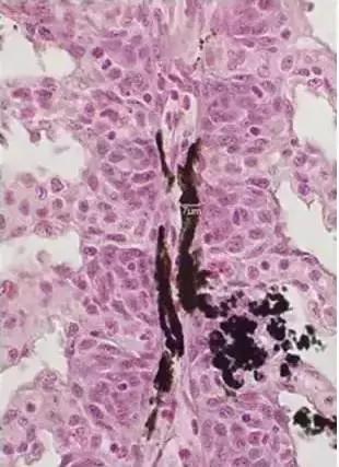 水产鱼鳃虫怎么治疗最好,鱼鳃霉病图片