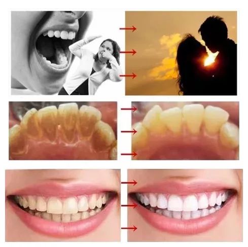 2岁半宝宝口臭幽门螺旋杆菌,4岁的宝宝有口臭是积食吗