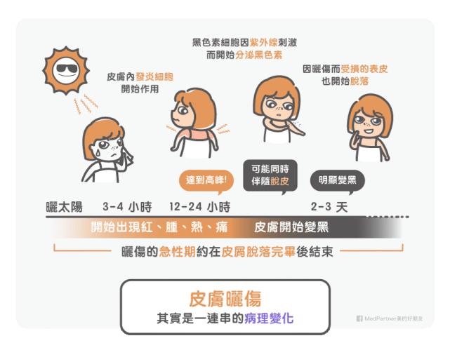 晒伤了用芦荟胶怎么修复,晒伤了发红怎么快速修复芦荟胶