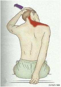 怎么改善溜肩让肩膀变平的视频,溜肩一招改善