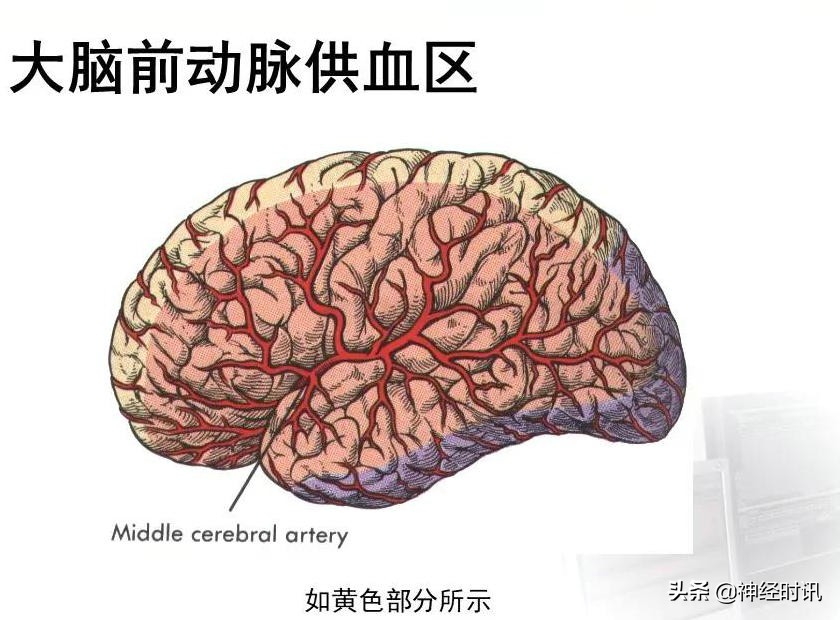 脑动脉解剖学讲解,基底节区脑血管解剖