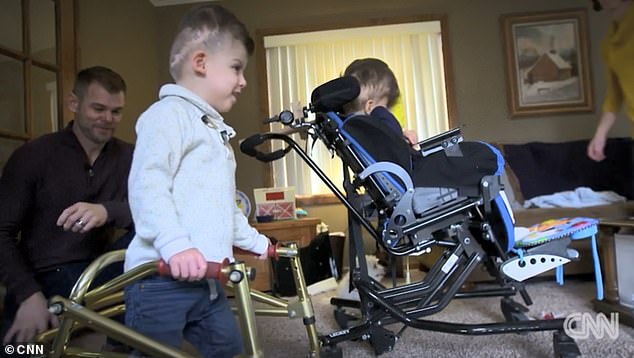 美国连体双胞胎成功分离案例,美国连体分离手术真实案例