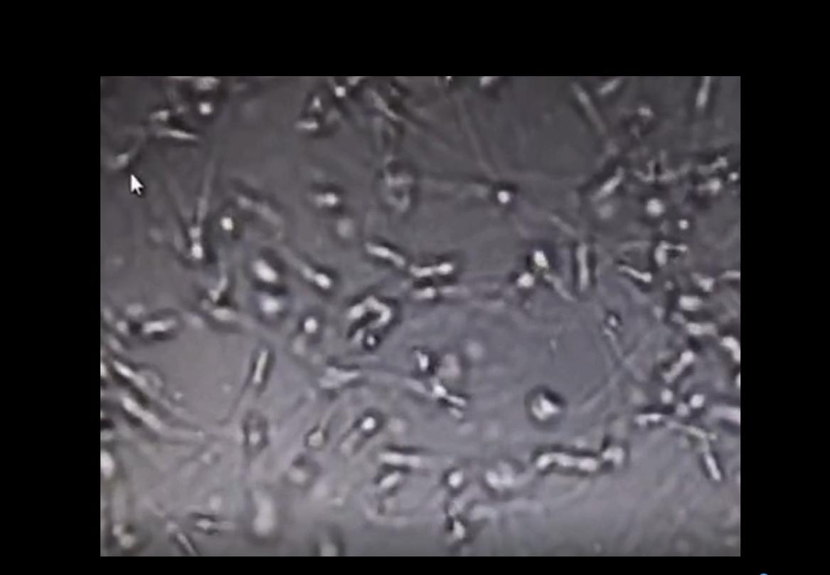 精子科学简史,生物学家辟谣精子的真相