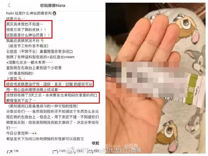 欧阳娜娜擦的药膏,欧阳娜娜擦什么药膏