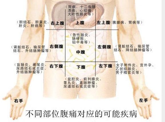 别小看腹痛诊断却大有学问,腹痛的诊断要点及鉴别诊断有哪些