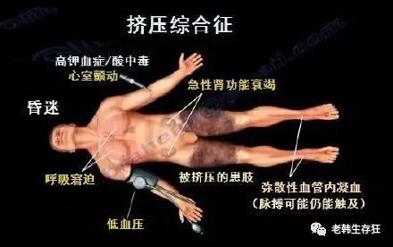 地震求生与自救技巧,生存狂在野外怎么逃生