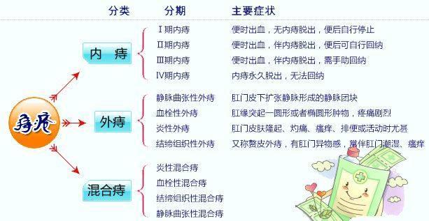 痔疮脱出3cm一般多久可以自愈,痔疮便血最佳自愈方法5个小妙招