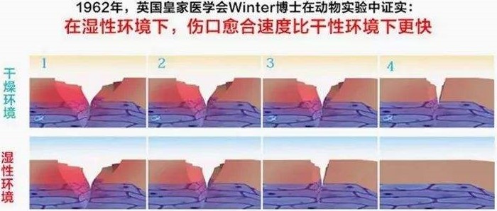 美食→生物材料|小龙虾和螃蟹→伤口敷料