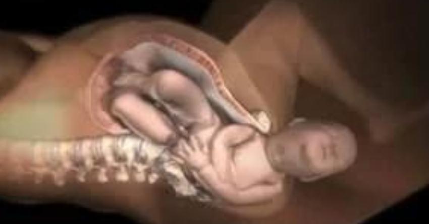 一分钟了解剖宫产视频,30秒了解剖宫产