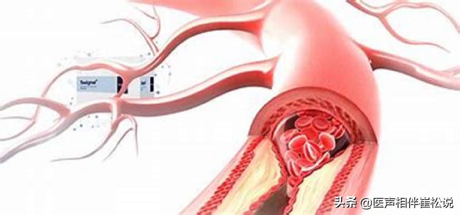 做好这几件事有助于康复,做好这四件事远离危险