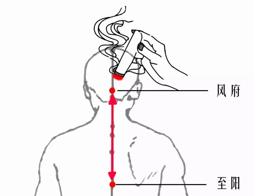 颈椎腰腿痛针刀,针刀颈椎病