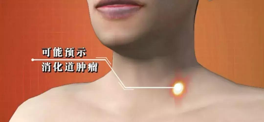 危险三角区会有什么症状,面部危险三角区有哪些危害