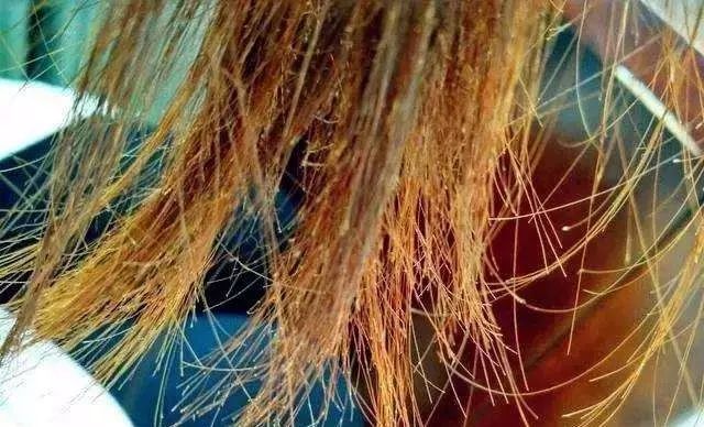 头发分叉断裂什么原因,头发干枯分叉怎么修复