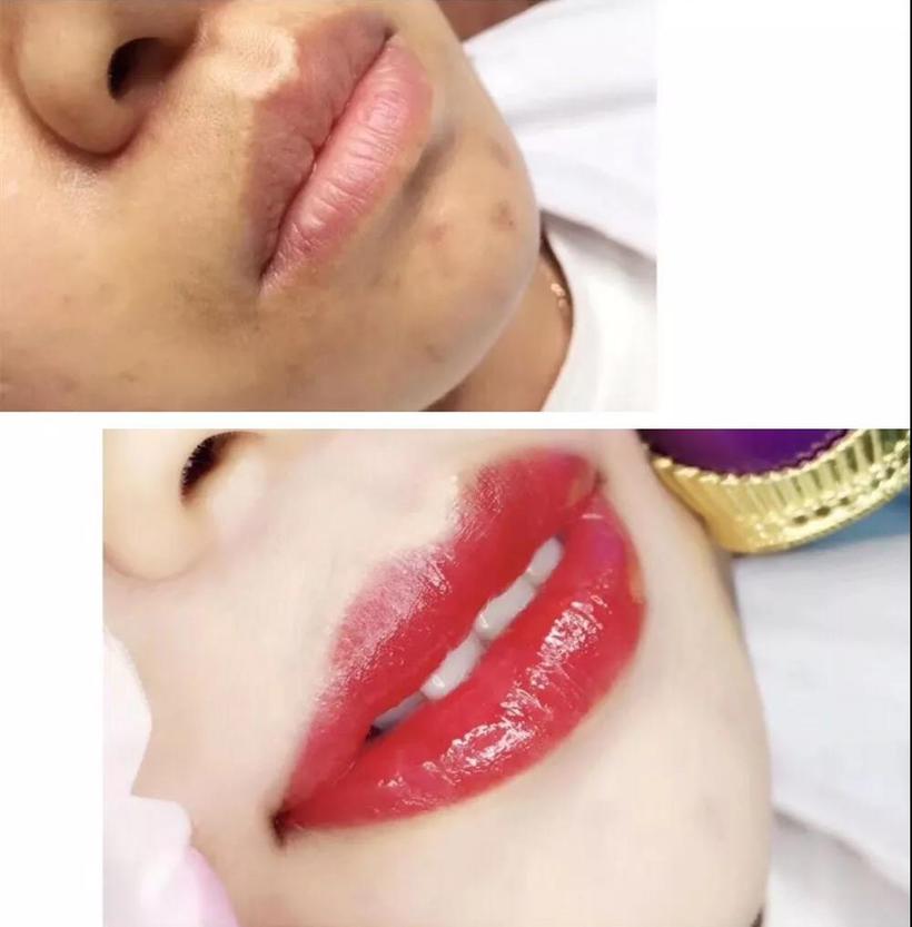 深圳传奇光学科技美容,深圳传奇光学祛斑仪器