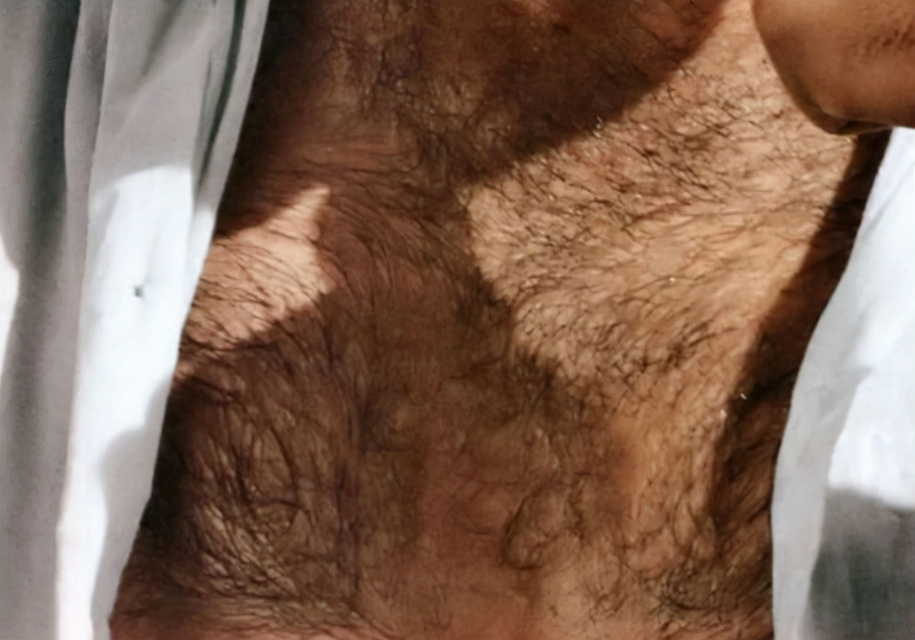 男胸部长毛什么原因引起的,男生胸部长毛是什么原因造成的