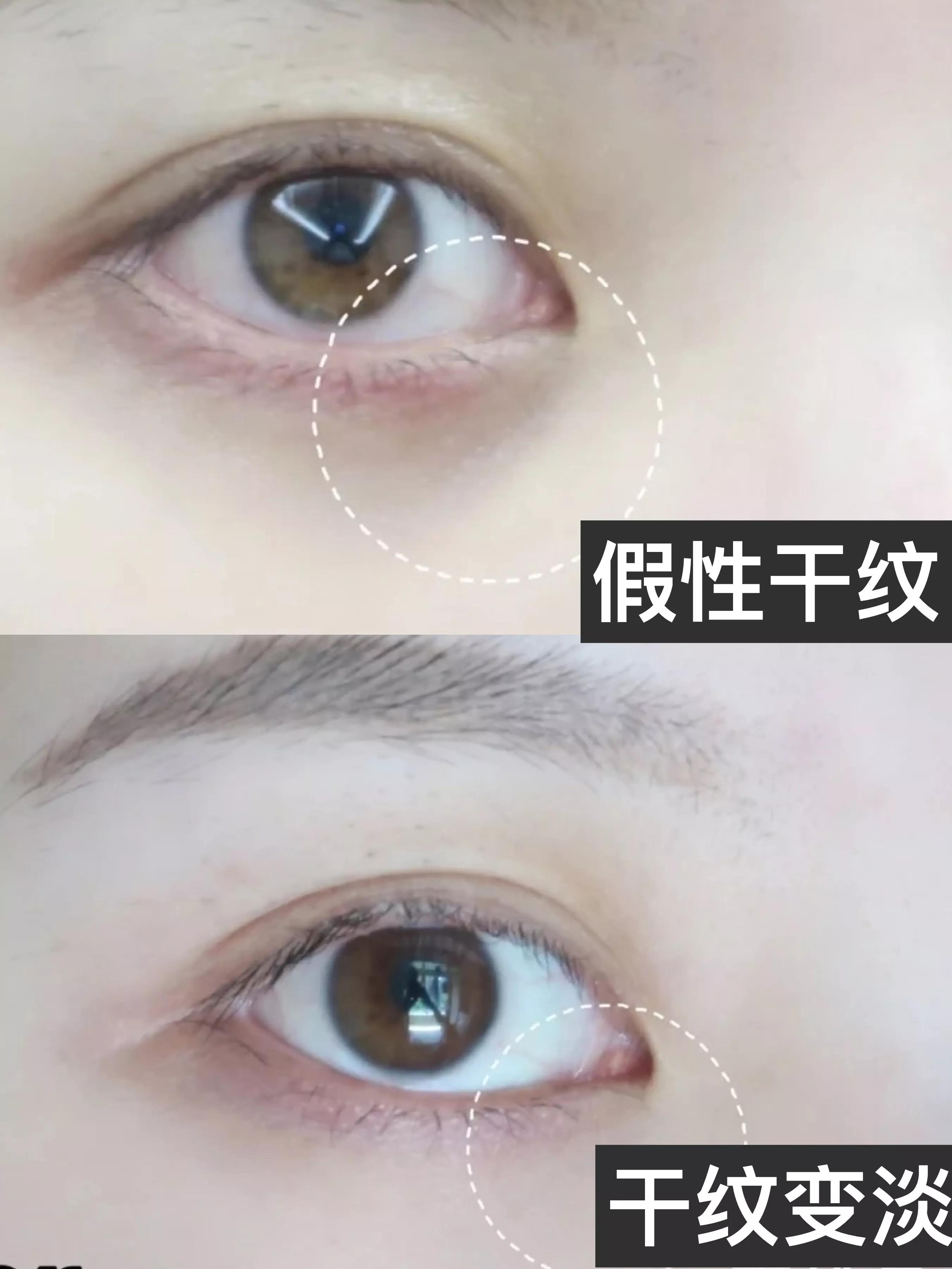 实名推荐这款国货眼霜,让你的wink电力十足