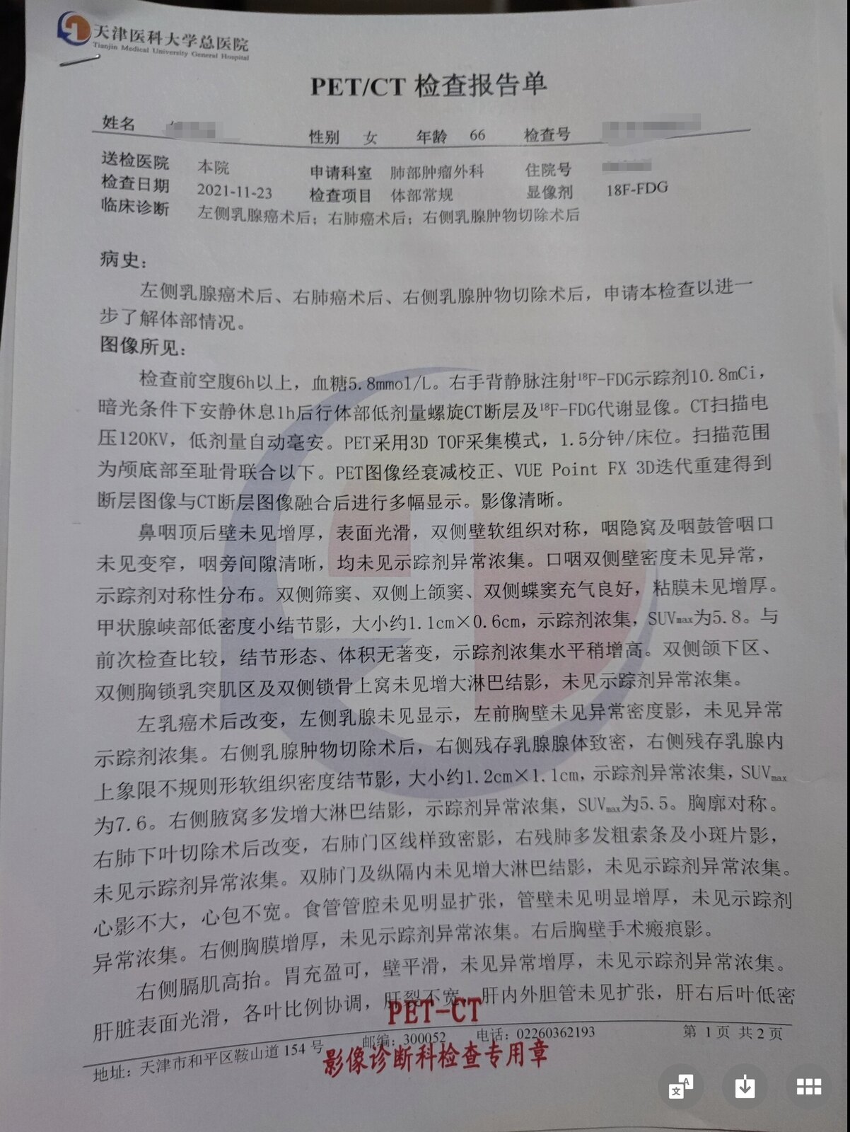 刘懿博士说肺癌,刘懿博士肺癌晚期