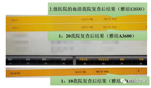 ca199一年比一年高原因,ca199前后相差20倍为什么