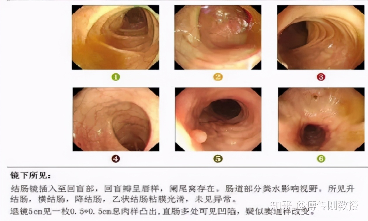 经历各种手术才活下来,经历了很多次手术