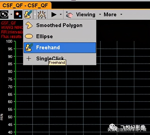 飞利浦磁共振快速扫描方案指南,飞利浦1.5t磁共振各部位扫描技术