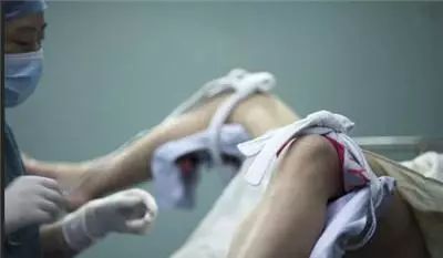 22岁女孩做6次人流,25岁女生人流两次