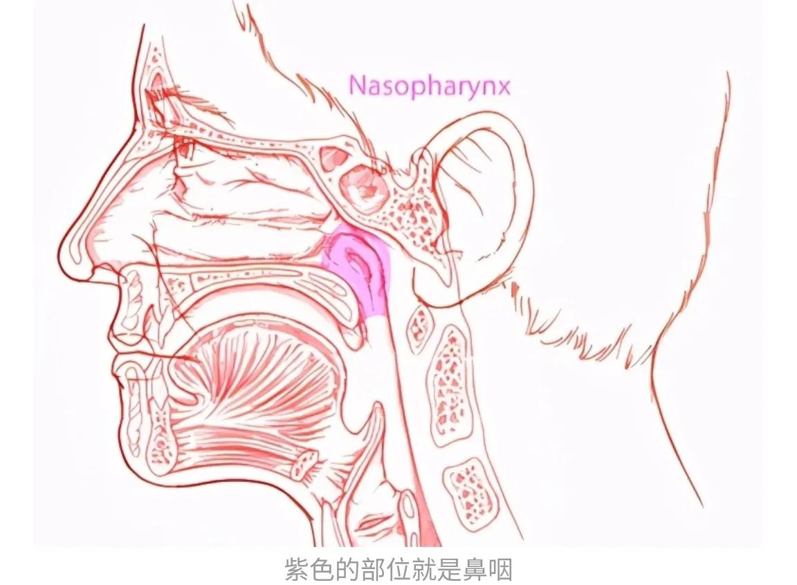 鼻咽癌怎么才能百分百筛查出来,哪些检查能查鼻咽癌症