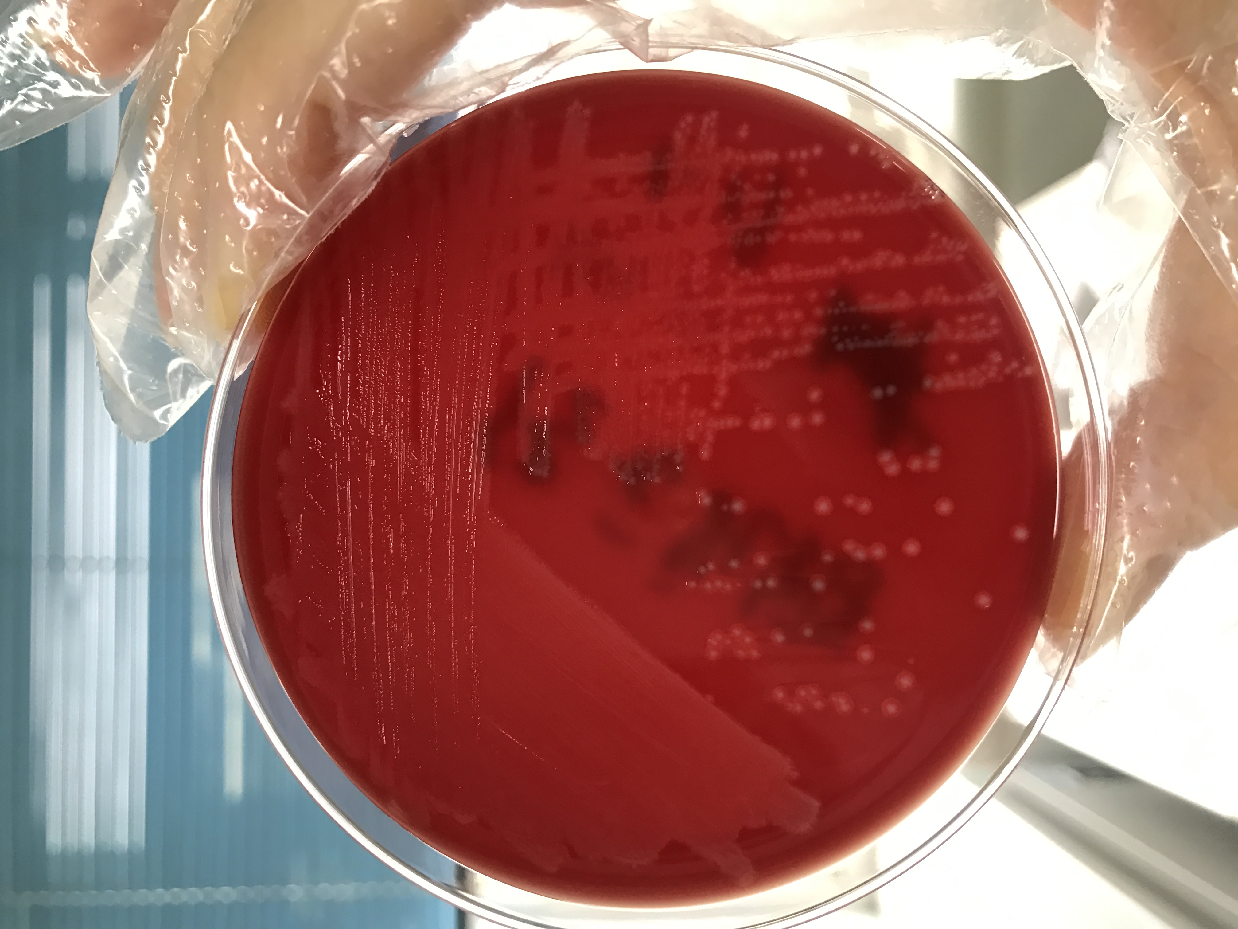 代孕对婴儿的健康危害,代孕婴儿的九大危害