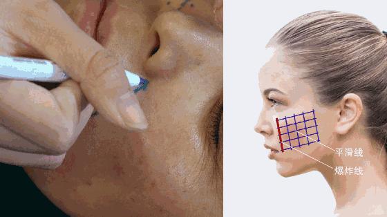 张宗学线雕视频,张宗学线雕第一人