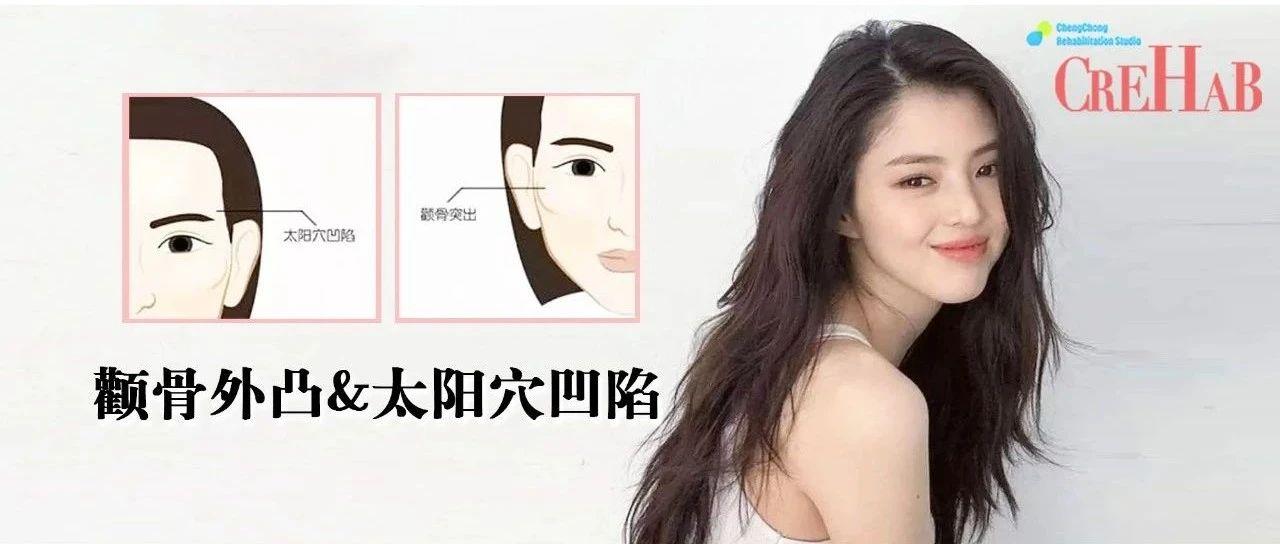 如何有效地改善颧骨,如何改善颧骨突出太阳穴凹陷