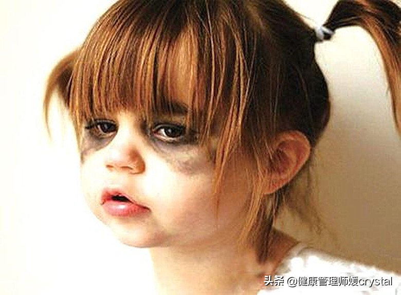 黑眼小孩辟谣,晚睡的孩子会有黑眼圈