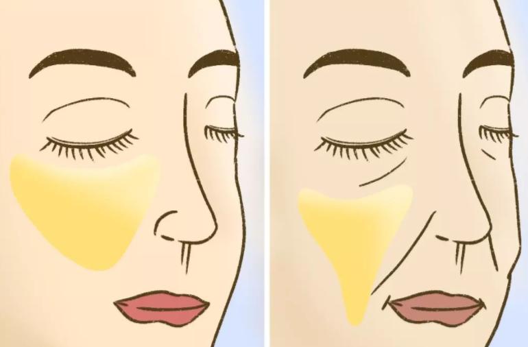 为什么法令纹比别的皱纹显老,最显老的皱纹法令纹