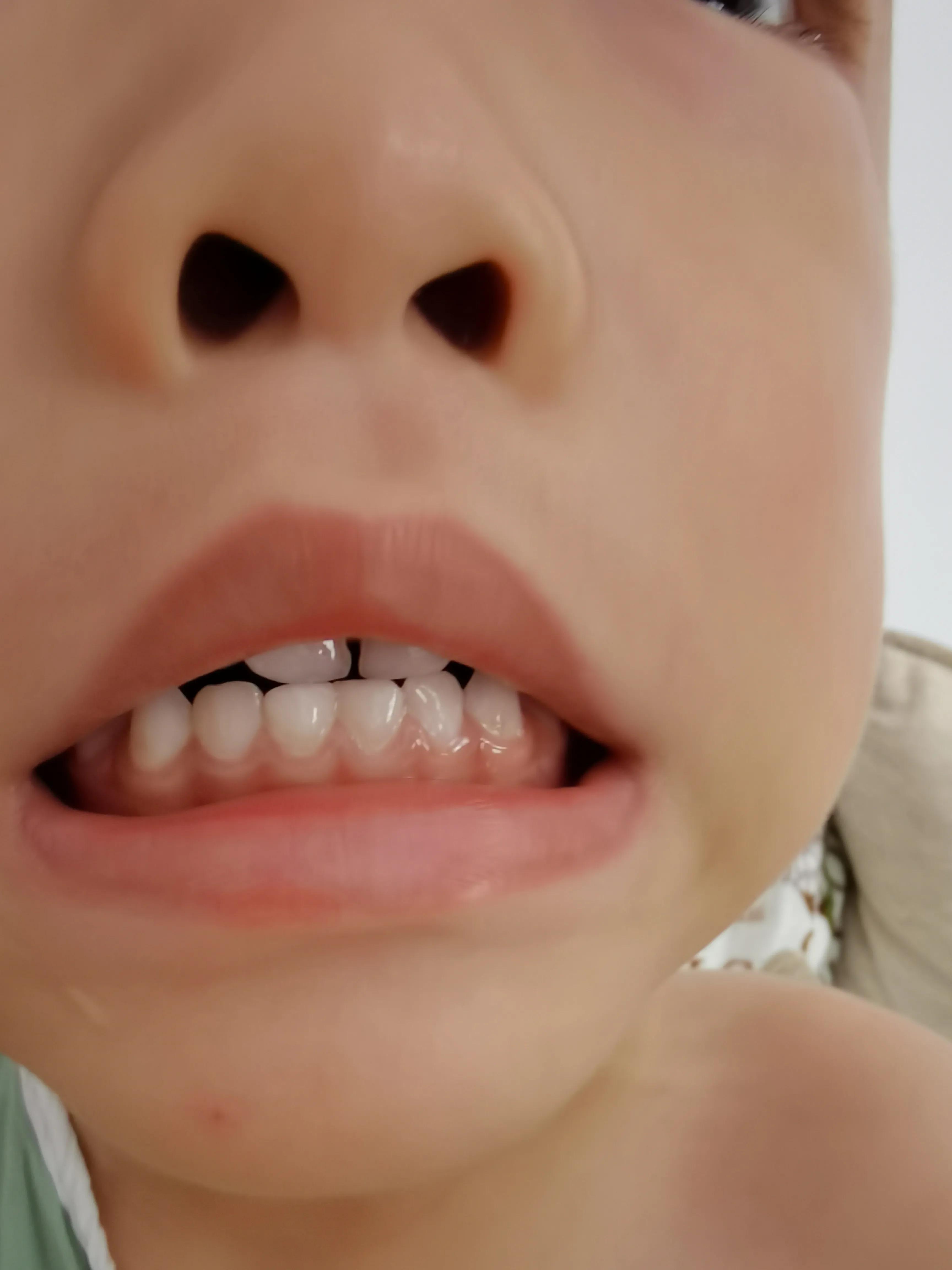 40岁后牙齿注意事项,5岁儿童换牙齿需要注意什么