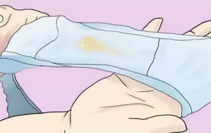 女性妇科白斑症状,女性妇科炎症是什么症状