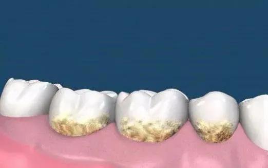 刷牙漱口杯可收纳电动牙刷,智能电动牙刷带收纳盒