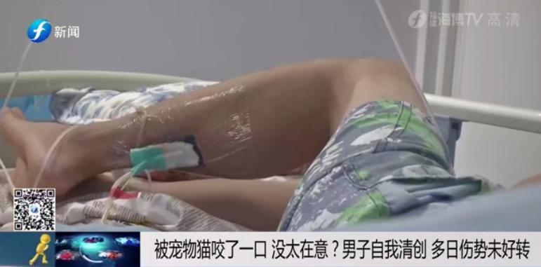 一个人在家里被大狗咬了,宠物猫咬主人一口主人被截肢