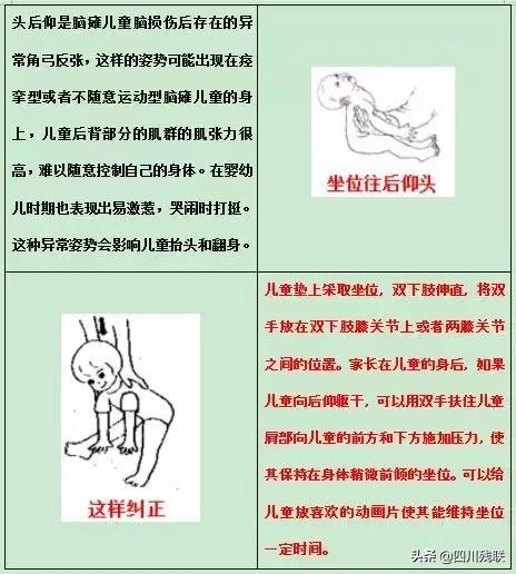 四川脑瘫康复训练有效果吗,成都脑瘫恢复中心