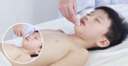 穴位养生堂“科普”小儿口疮怎么用中医疗法调理?