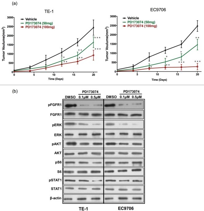 华西食管鳞状细胞癌专家,食道中分化鳞状细胞癌预后