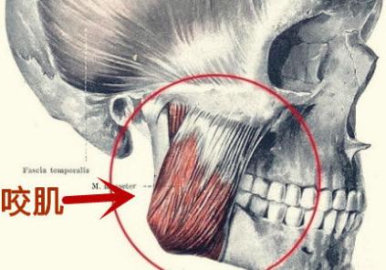 30多岁还能改善下巴后缩吗,30岁还能下颌后缩矫正吗