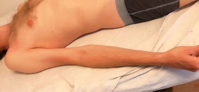 大循环治膀胱经从屁股到膝盖窝麻痛与久咳