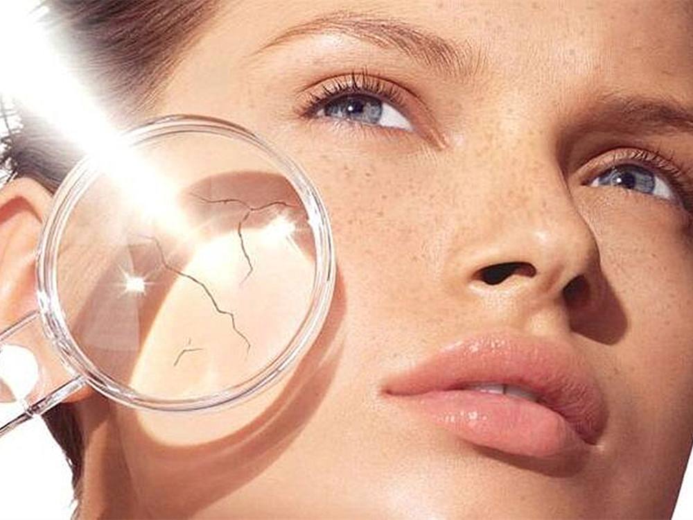 脸嘴唇干燥脱皮紧绷刺痛,冬季脸干燥脱皮紧绷刺痛