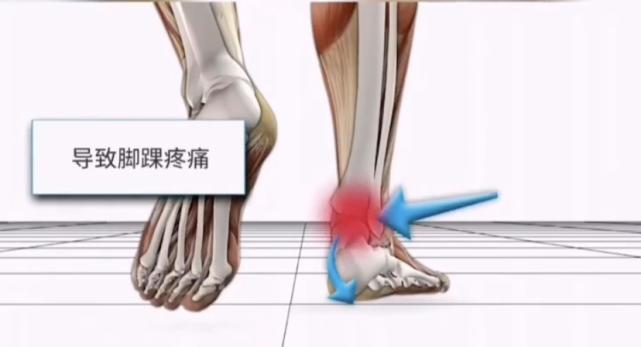 孩子走路“内八”or“外八”，可能和这3个小习惯有关