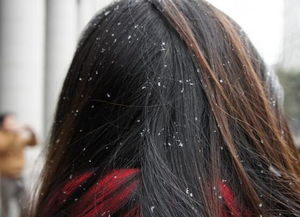 皮肤干燥头皮屑多吃什么维生素,头皮屑多嘴唇发干怎么回事