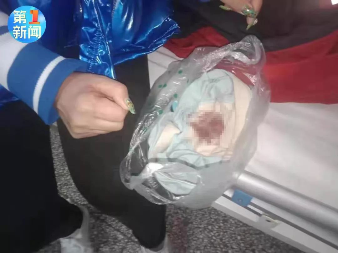 可怕男孩被老师砸脚底板,男老师狠踢学生踢腿骨折